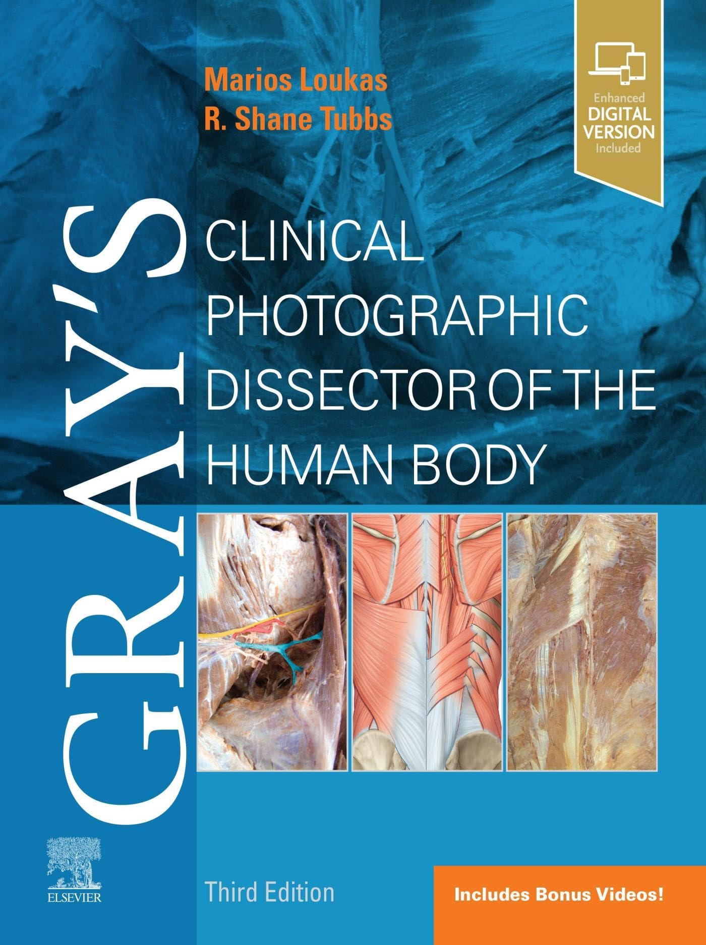 Gray's Clinical Photographic Dissector of the Human Body E-Book (Gray's Anatomy)