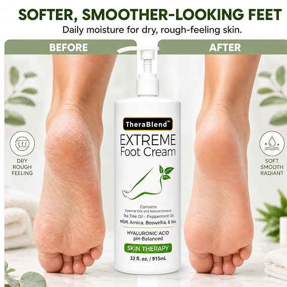 CryoDerm TheraBlend Extreme Foot Cream 32 oz
