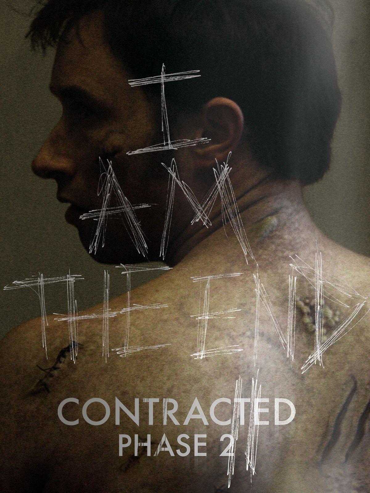 Contracted: Phase 2