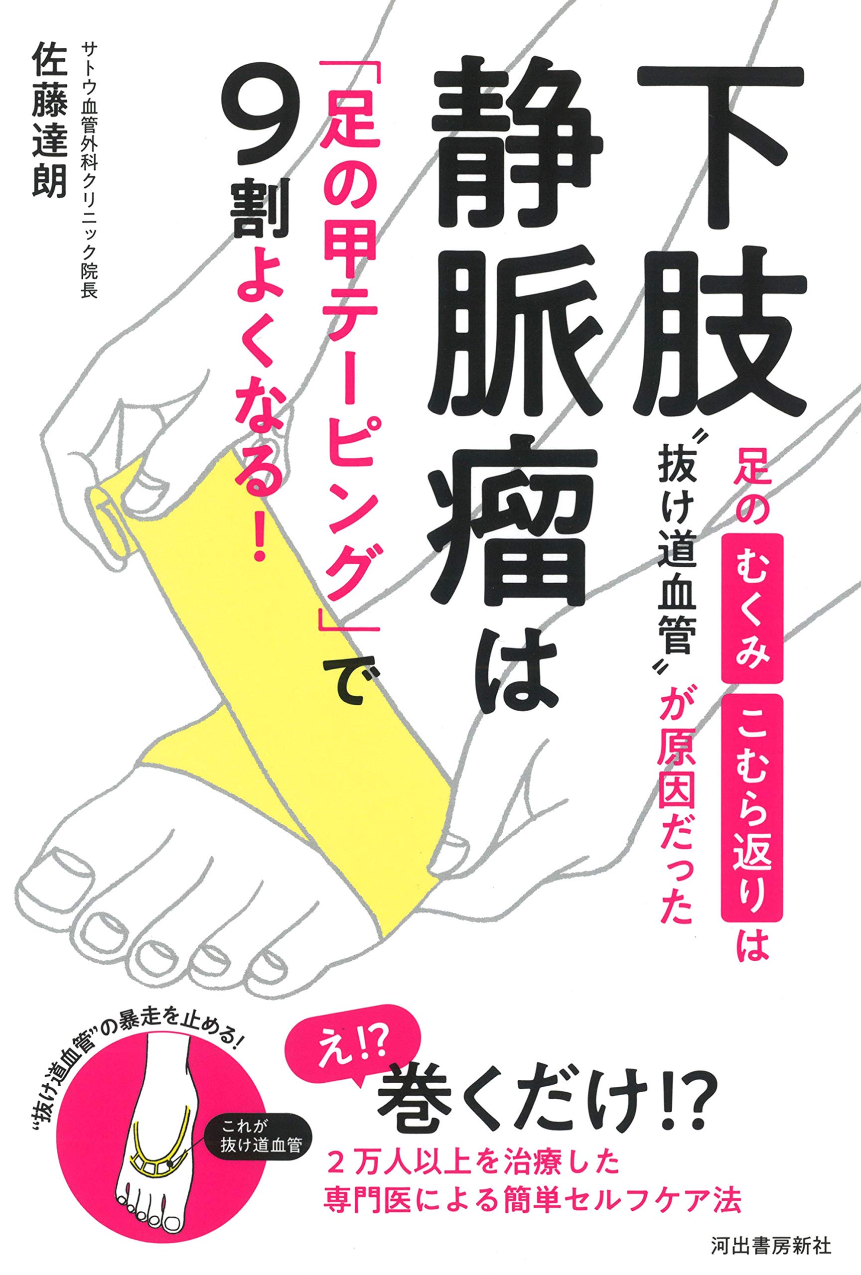 下肢静脈瘤は 足の甲テーピング で9割よくなる 足のむくみ こむら返りは 抜け道血管 が原因だった 達朗 佐藤 本 通販 Amazon
