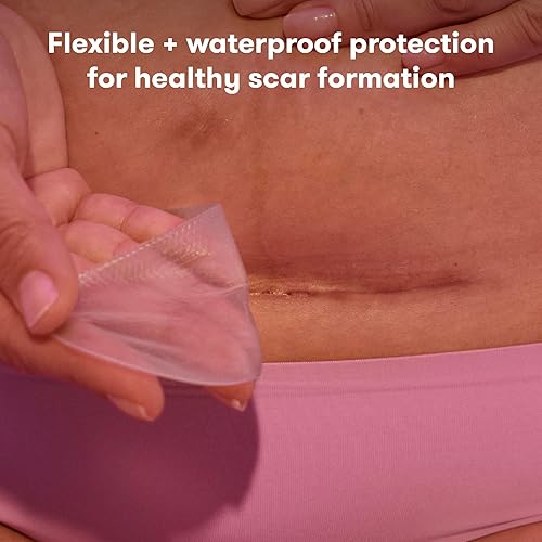 Miniatura 2 de Frida Mom Tiras de silicona para cesárea, parches de cicatriz imprescindibles para la recuperación de cesárea, tratamiento reutilizable de grado
