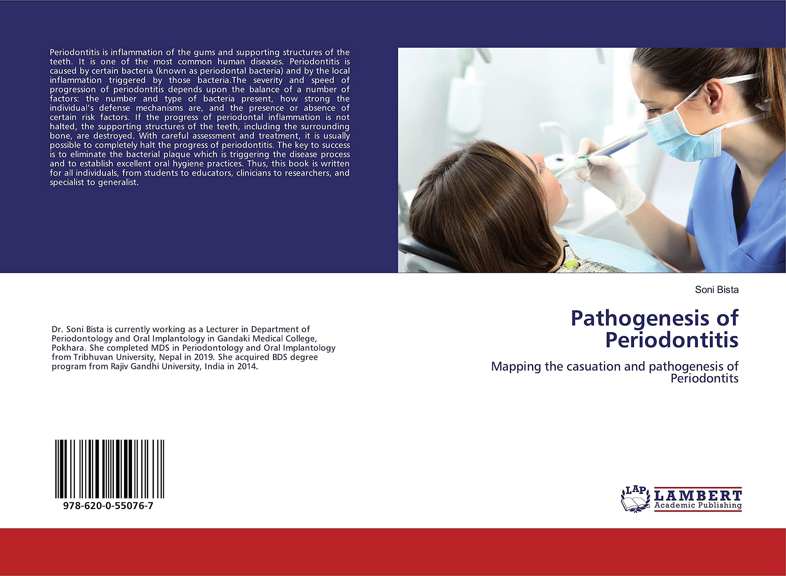 Pathogenesis of Periodontitis: Mapping the casuation and pathogenesis of Periodontits