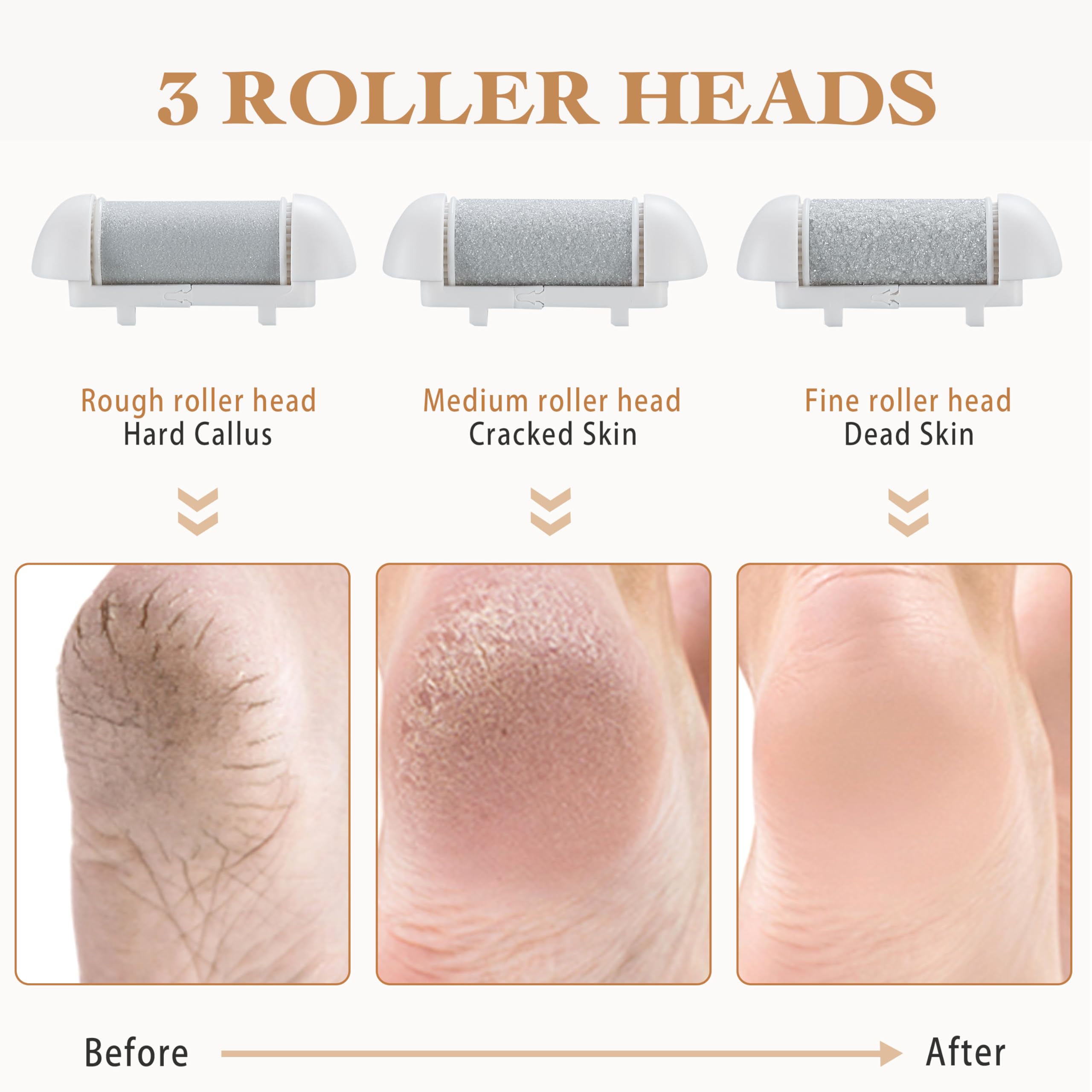 BarberBoss Electric Foot File Hard Skin Remover - Image 2