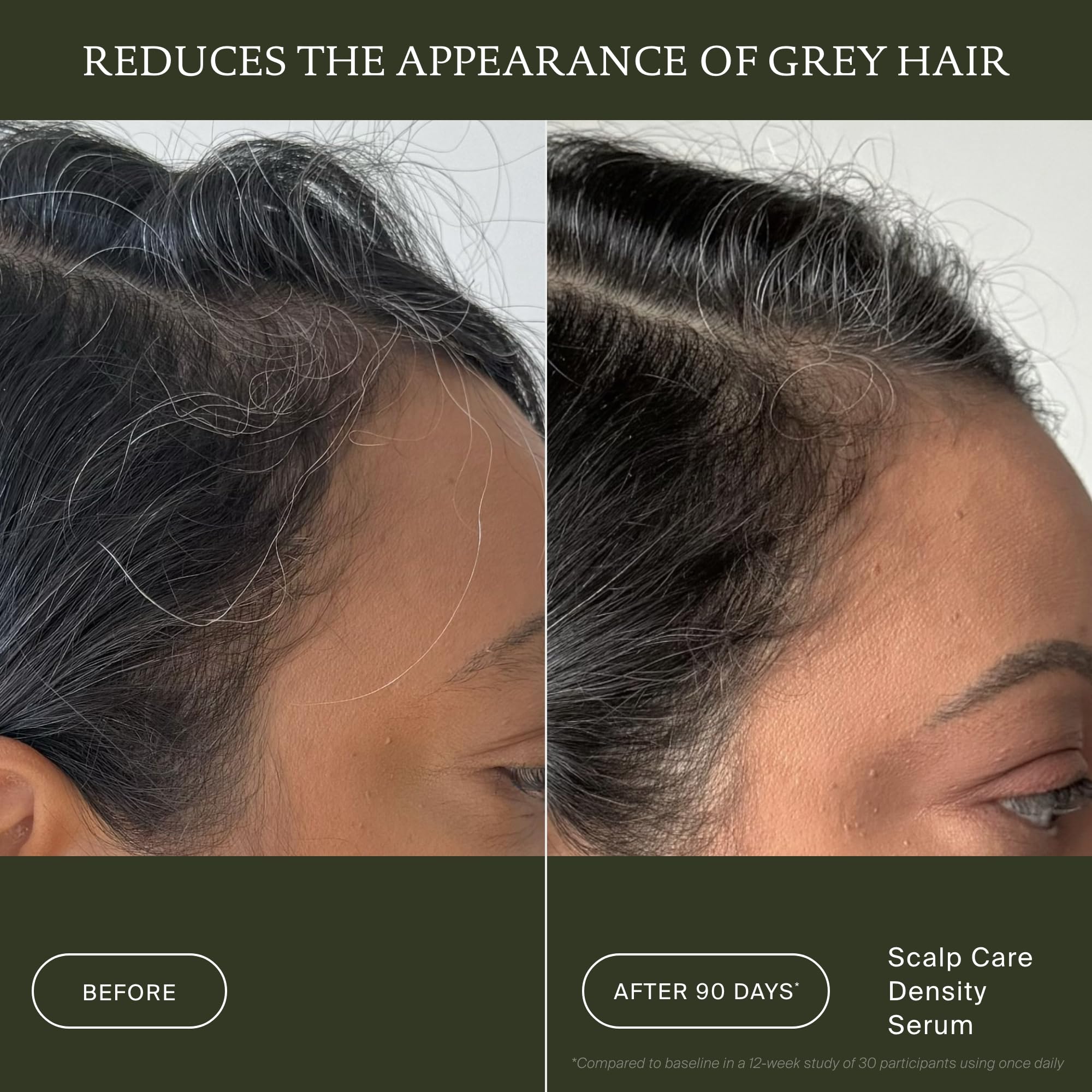 Living Proof Scalp Care Density Serum (50ml) – Serum für gesunde Kopfhaut & Haardichte – Gegen Haarausfall & graues Haar – Schnell einziehend & nicht ausspülbar – Für volleres, kräftigeres Haar