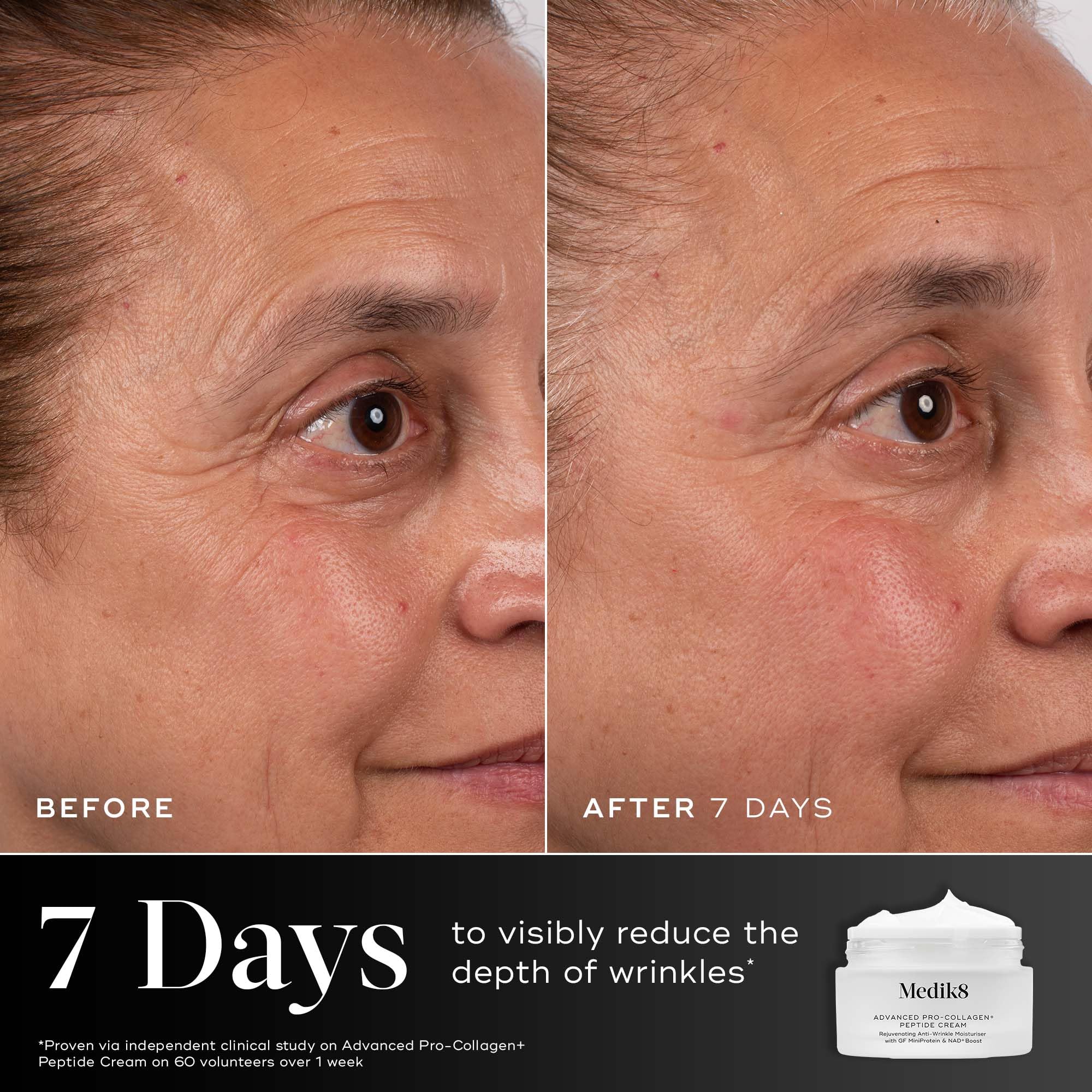 Medik8 Advanced Pro-Collagen+ Peptide Cream – Verjüngende Anti-Falten-Feuchtigkeitscreme mit Growth Factor MiniProtein & NAD+ Langlebigkeits-Booster - 50ml | Verjüngende Anti-Falten-Feuchtigkeitspflege mit Wachstumsfaktor MiniProtein & NAD+ Longevity Boos