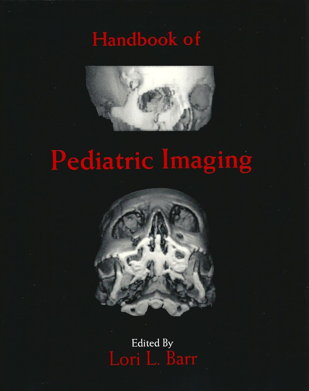 Buy Handbook of Paediatric Imaging (Handbooks of diagnostic imaging