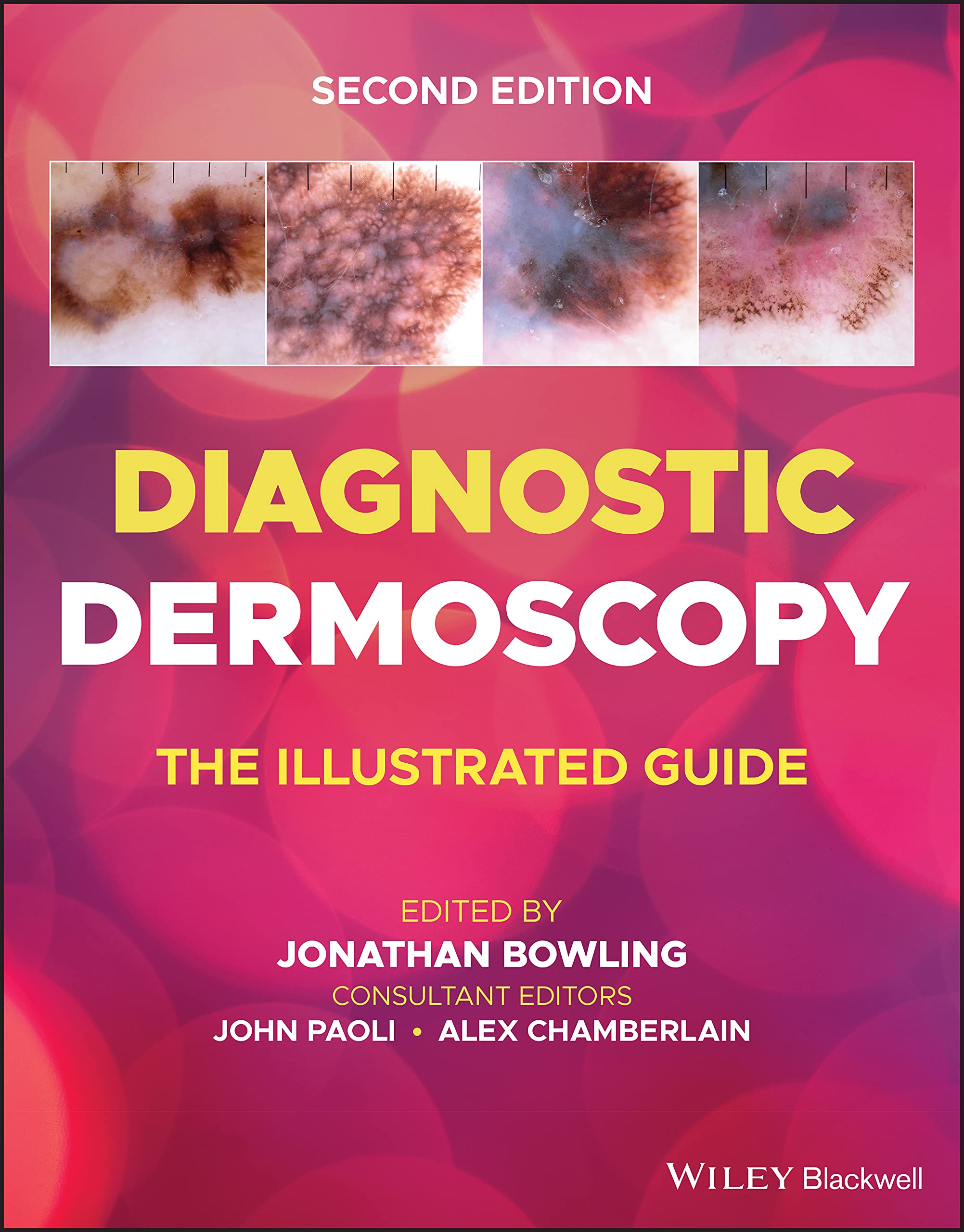Wiley-Blackwell Diagnostic Dermoscopy: The Illustrated Guide