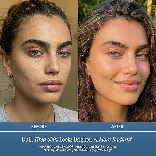 Miniatura 4 de Mascarilla de vitamina C para la cara – Mascarillas iluminadoras para el cuidado de la piel contiene ácido glicólico y ácido láctico + aceite de