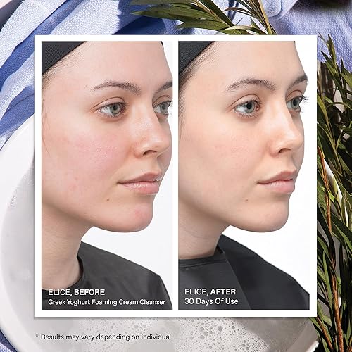 Miniatura 5 de KORRES Limpiador en Crema Espumosa de Yogur Griego, Hidratante, Cuidado de la Piel de Limpieza Profunda, Desmaquillante, Limpiador Facial para