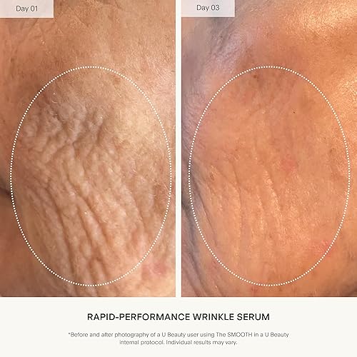 Miniatura 3 de U Beauty The SMOOTH Dynamic Wrinkle Defense Serum - Complejo multipéptido, péptidos de cobre, retinol, exosomas de centella, proteína de seda vegana