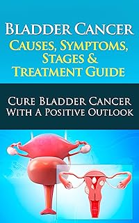 Bladder Cancer Causes, Symptoms, Stages & Treatment Guide: Cure Bladder Cancer With A Positive Outlook