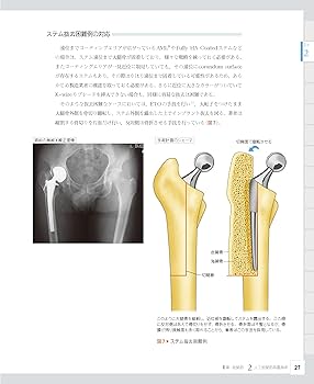整形外科医のための下肢のアドバンスト手術 上級医になるために