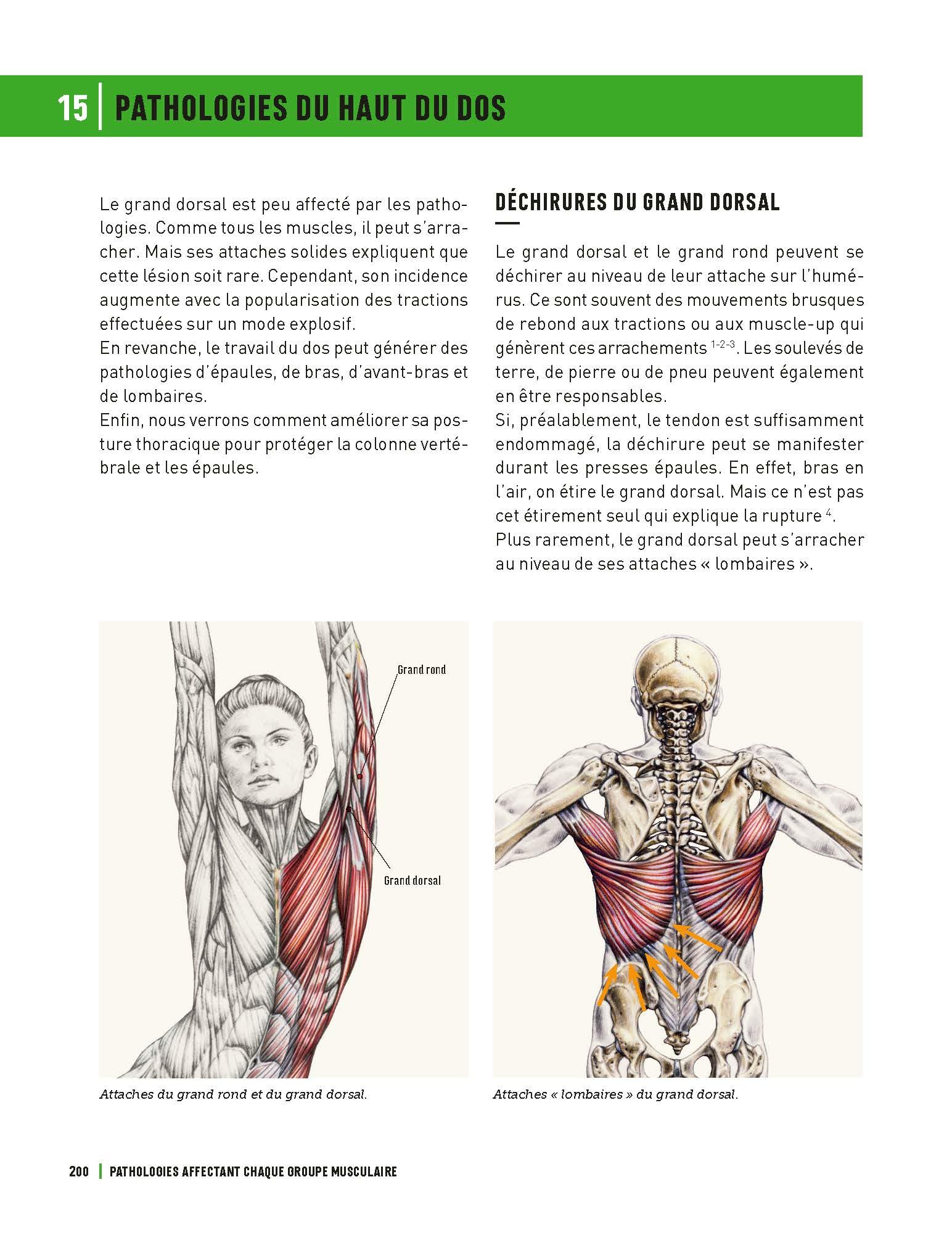 Blessures en musculation et sports de force