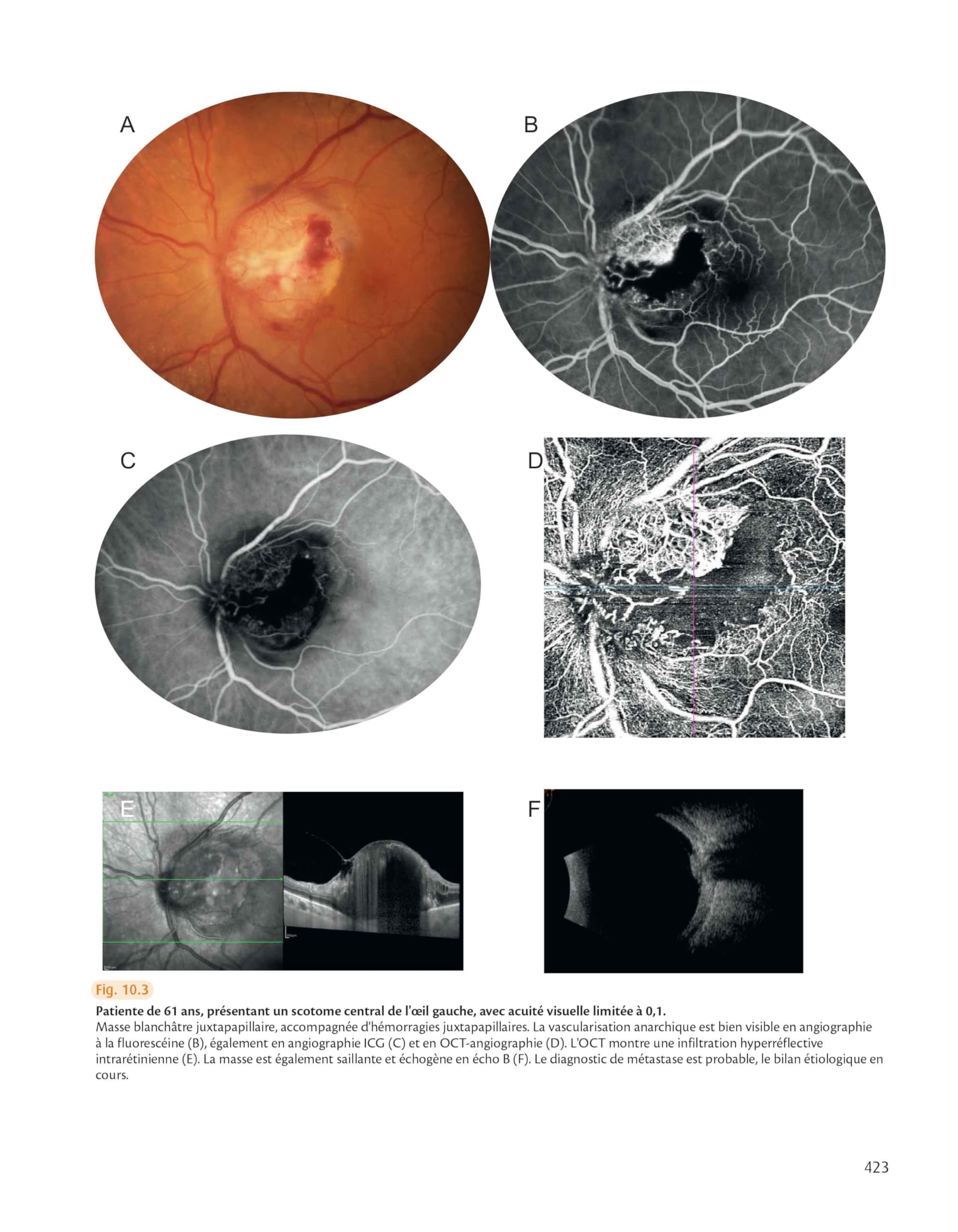 Rétine : atlas des maladies du fond d'oeil