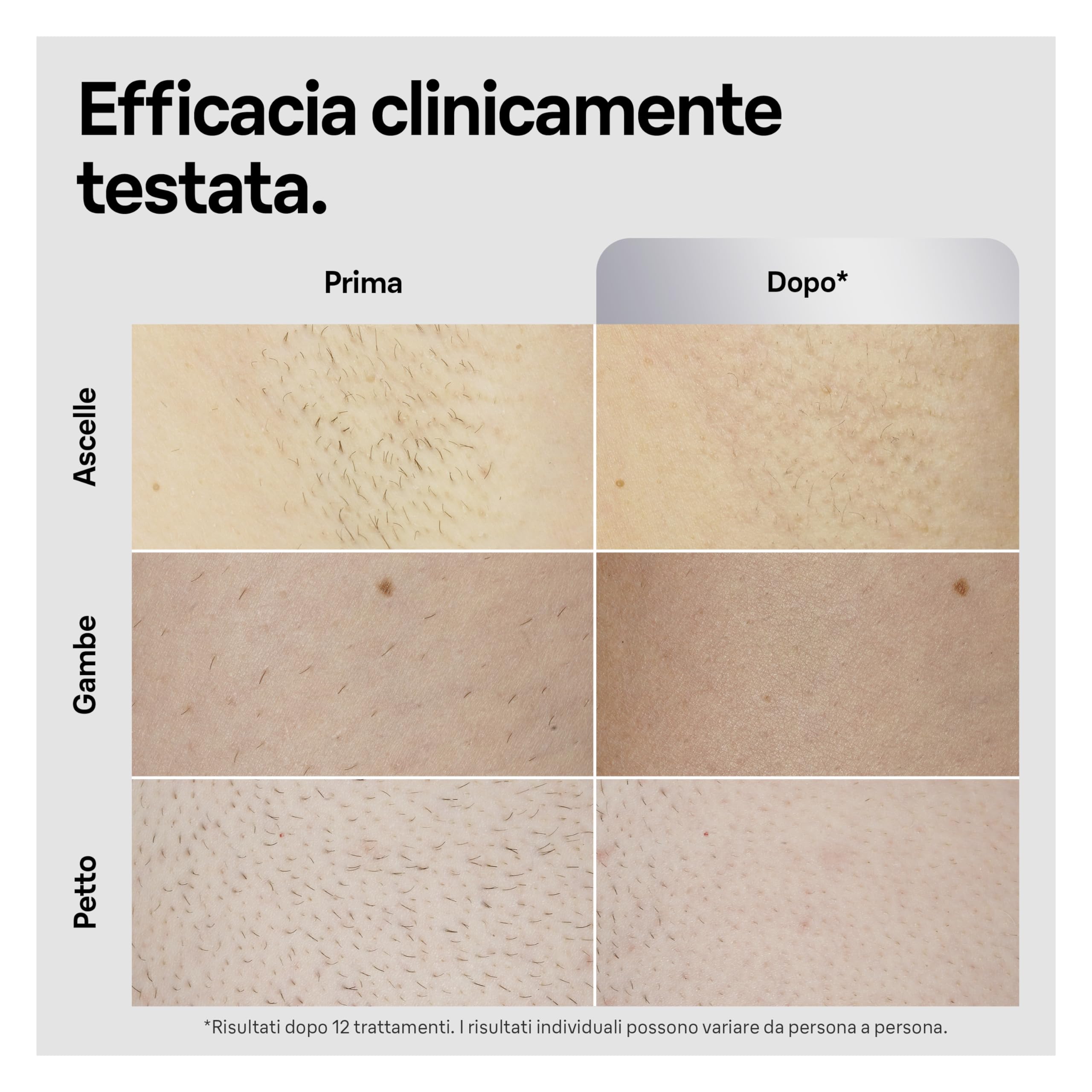 Braun Silk·expert Pro 5 Epilatore LUCE PULSATA, Epilazione A Casa, Alternativa All’Epilazione laser, Con Custodia, Rasoio Uomo Gillette, 2 Testine, Idea Regalo, Bianco/Oro, PL5145
