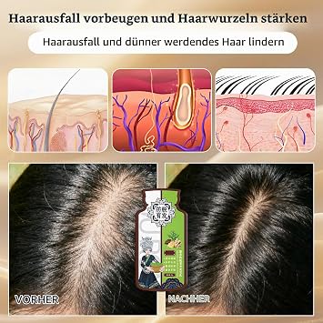 Ginger Anti-Hair Loss Shampoo Y5B-C20-01 Nourishes the scalp reduces hair loss strengthens hair - 10 individual bags for on the go