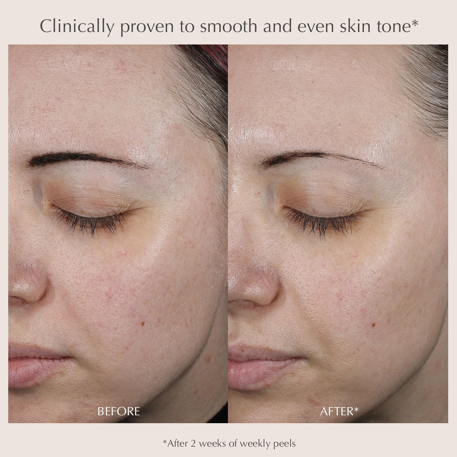 EXUVIANCE Performance Peel AP25, At-Home Chemical Peel with Glycolic Acid, Gently Refines Pores, Anti-Aging Peel, Treats Fine Lines, Wrinkles & Uneven Texture|Mandelic and Polyhydroxy Acids - Image 7