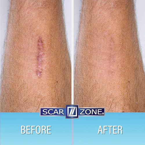 Miniatura 4 de Crema Avanzada para Cicatrices 0.75oz (paquete de 2)