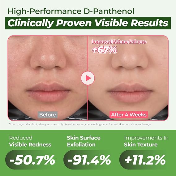JUMISO D-Panthenol Hydrating Serum 10 Types Hyaluronic Acid for Oily Dehydrated Sensitive Skin Cooling Watery Texture, Non-Sticky, BHA + Niacinamide Pore Care Fragrance-Free, Jumbo 2.37 fl oz