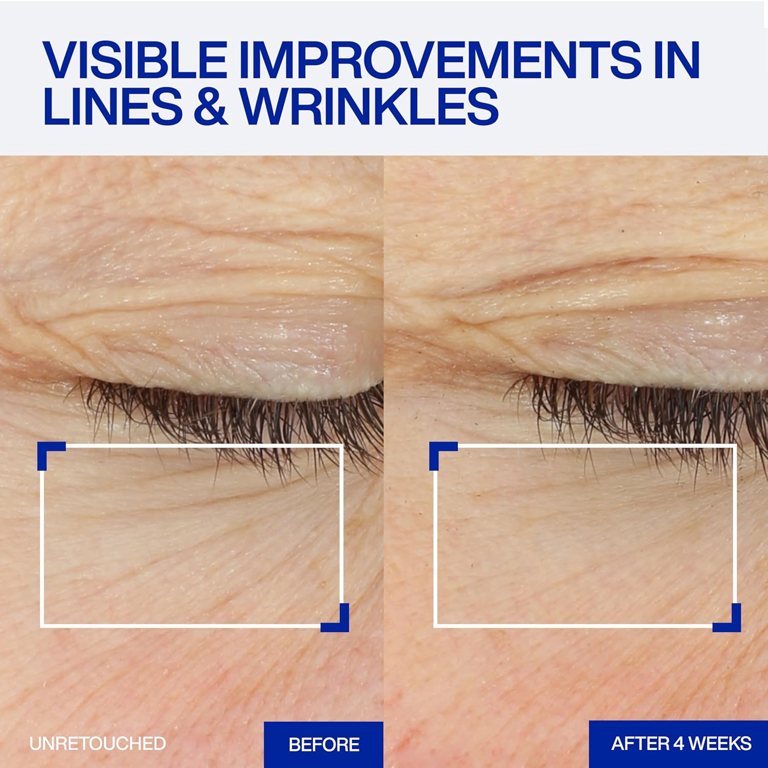 IOPE Expert Retinol RX 2% Reti-Jection Serum - Anti-Aging Night Serum - Visibly Smooths Wrinkles, Firms Skin, and Refines Pores - Potent & Gentle - 1.01 fl. oz.