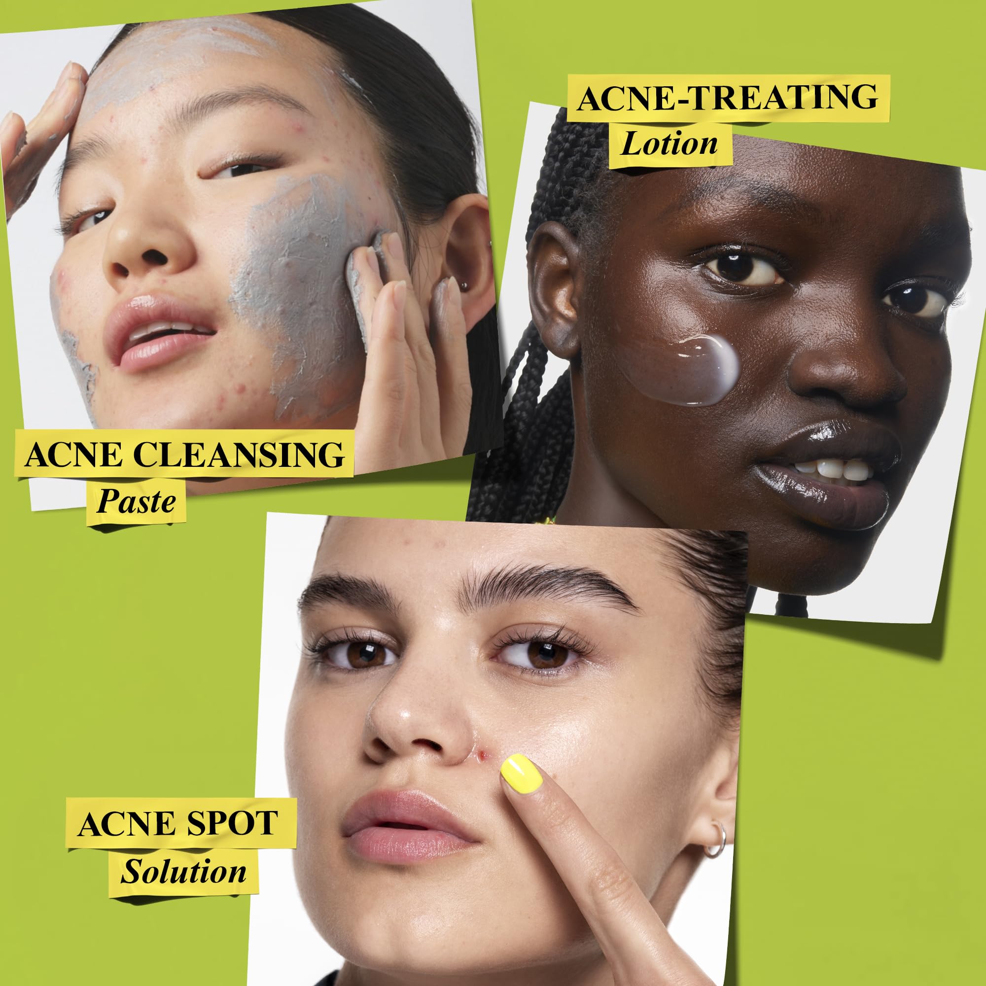 Kiehl's Acne-Clearing Skincare Routine Gift Set with Pimple Patch, 3-Piece