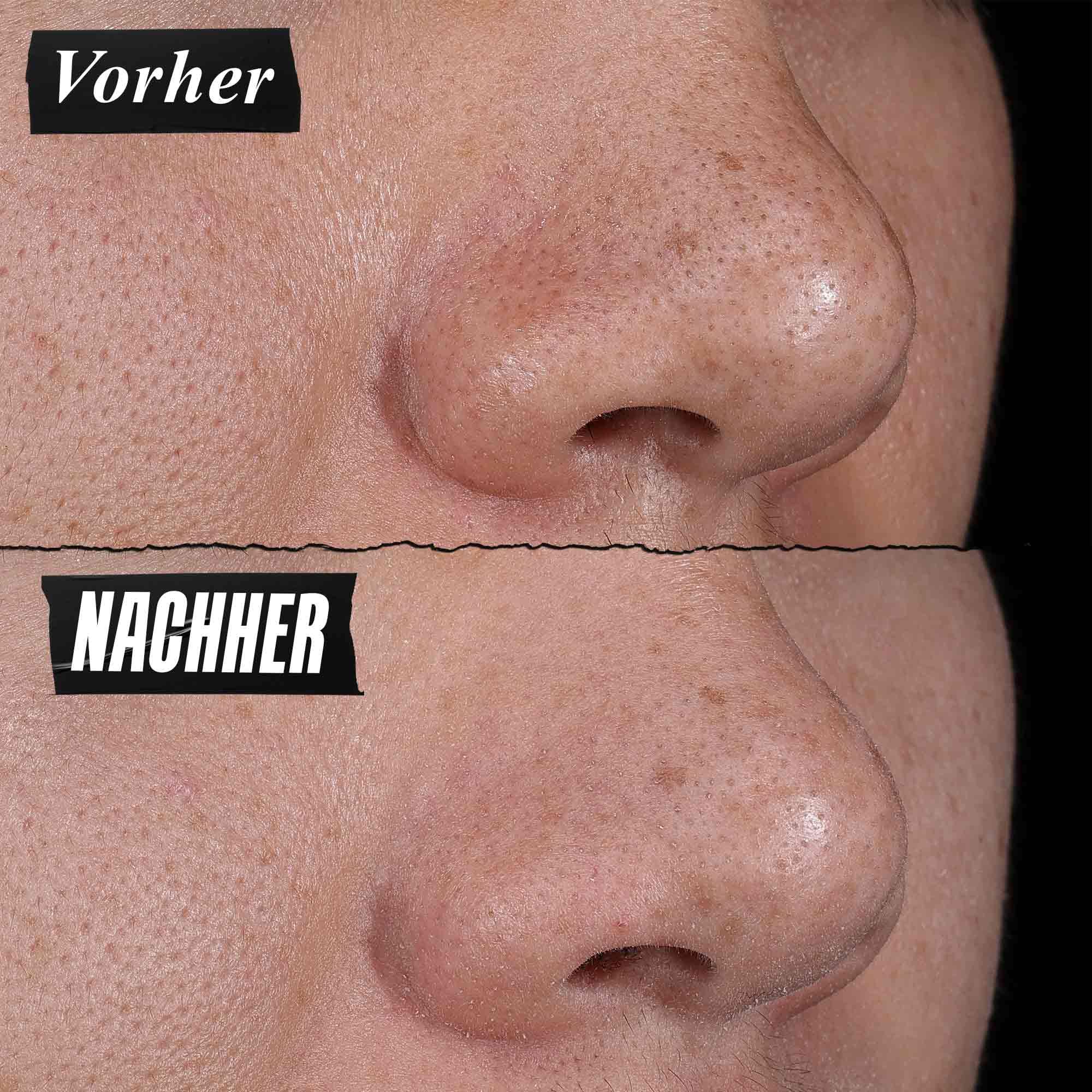KIEHL'S Rare Earth Deep Pore Cleansing Mask, 125 ml, reinigende Detox-Gesichtsmaske mit Aloe Vera und Amazonas-Tonerde, Anti Pickel Gesichtsreiniger zur Minimierung von Poren und Mitessern