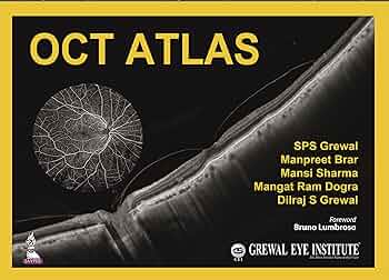 OCTアトラス 81K6Y2wD0BL._UF350,350_QL50_.jpg