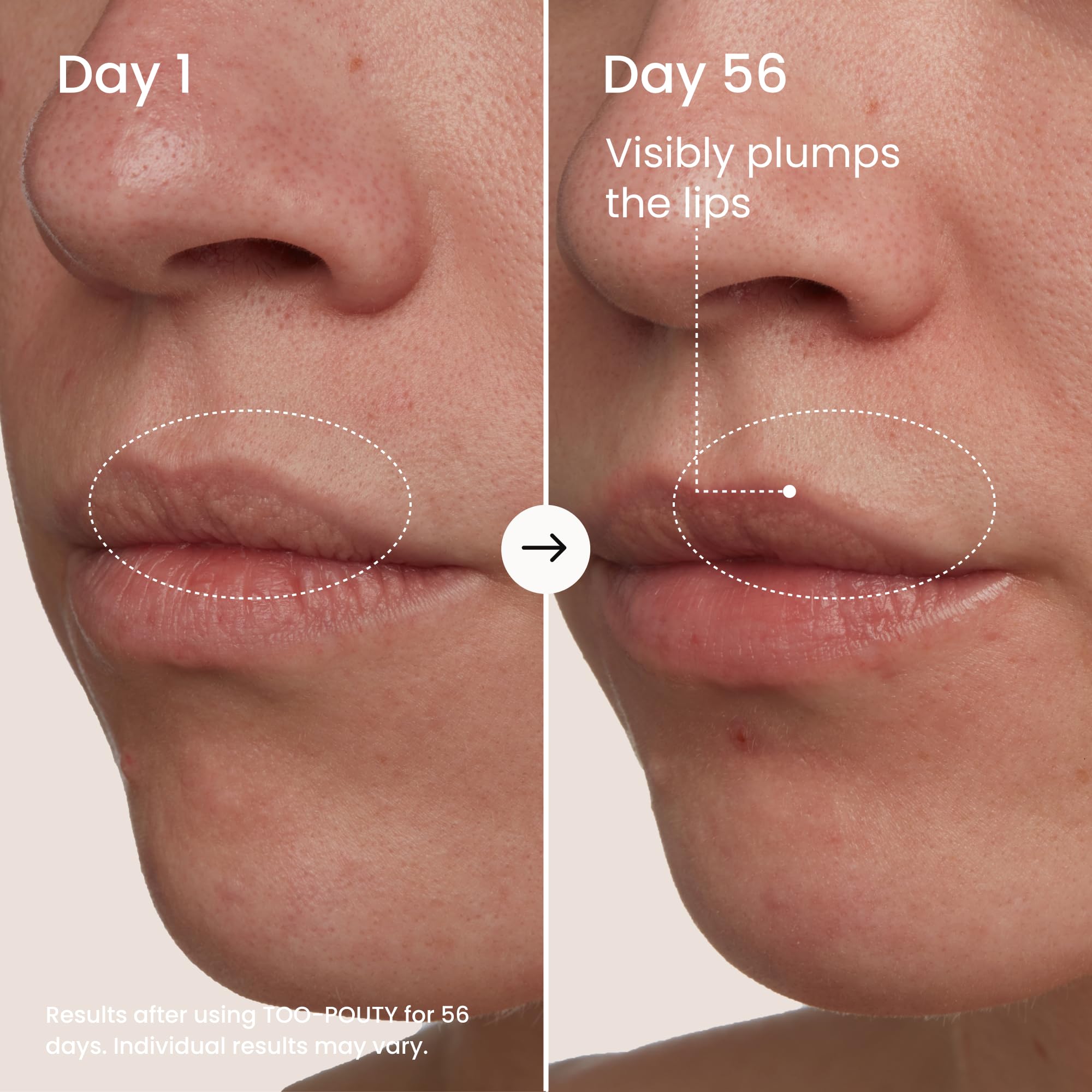 MAËLYS TOO-POUTY Lip Plumping Mask - Dual-Use Lip Treatment and Primer - Visibly Smooths Fine Lines and Enhances Fullness (0.5 Fl Oz)