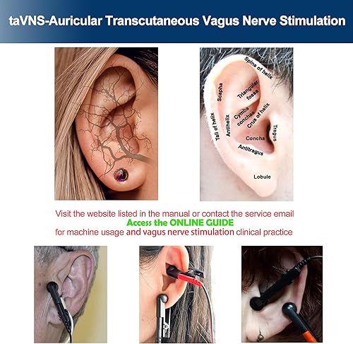 Miniatura 3 de TENS - Pinzas para la estimulación del nervio vago, electrodos de silicona duales