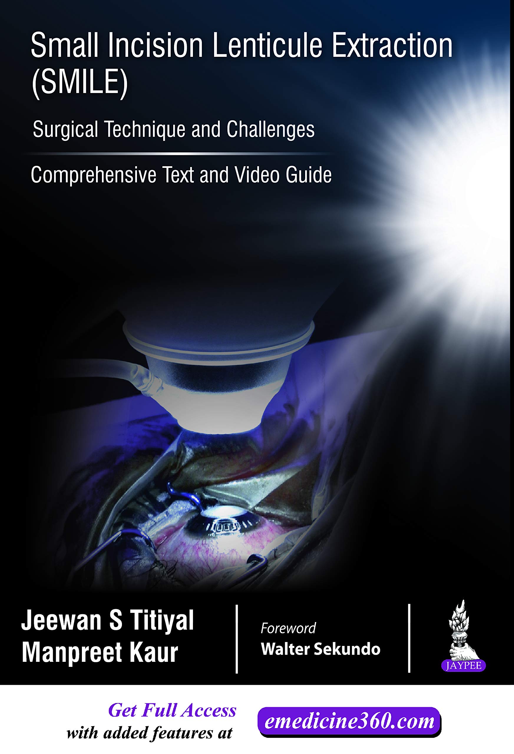 Small Incision Lenticule Extraction (SMILE): Surgical Technique and Challenges (Comprehensive Text and Video Guide) (English Edition)