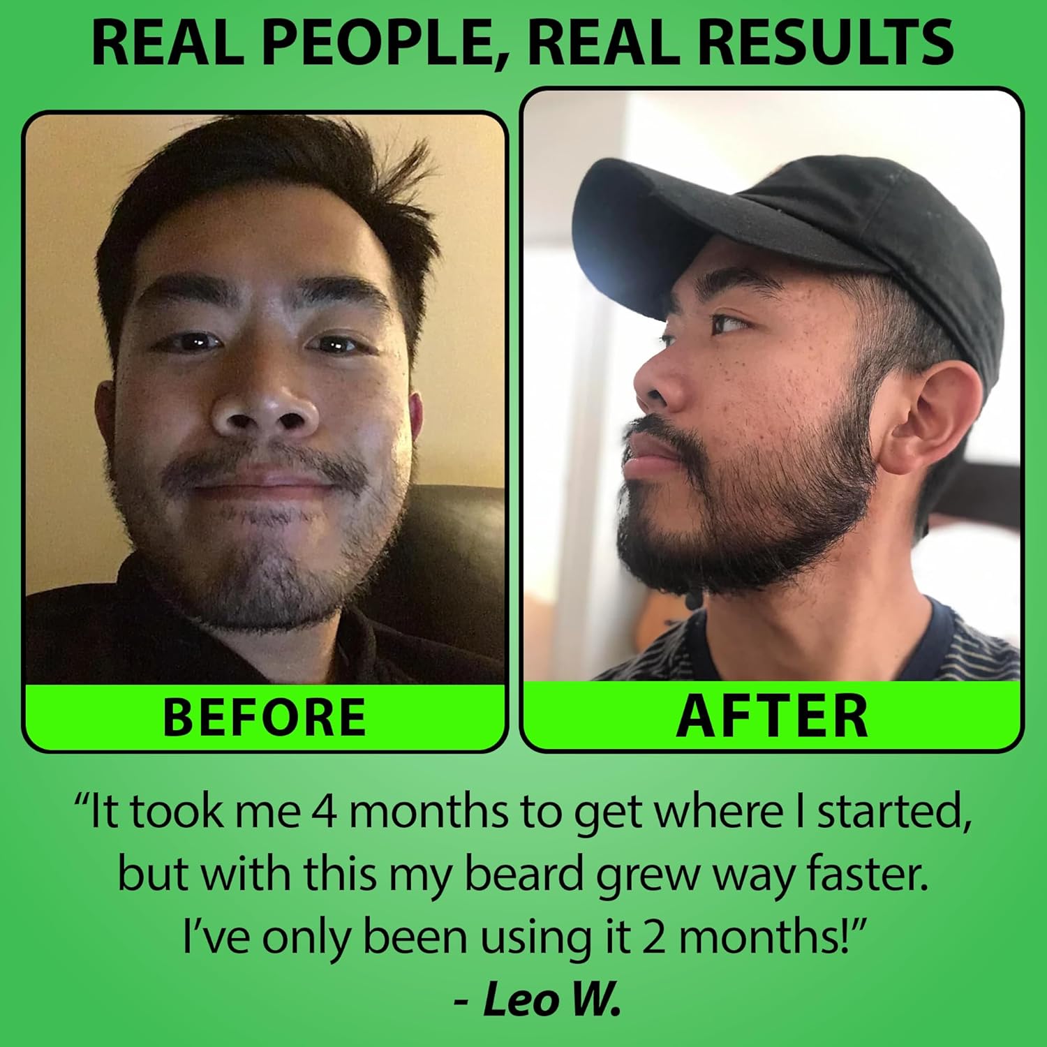 beard roller and serum close-up