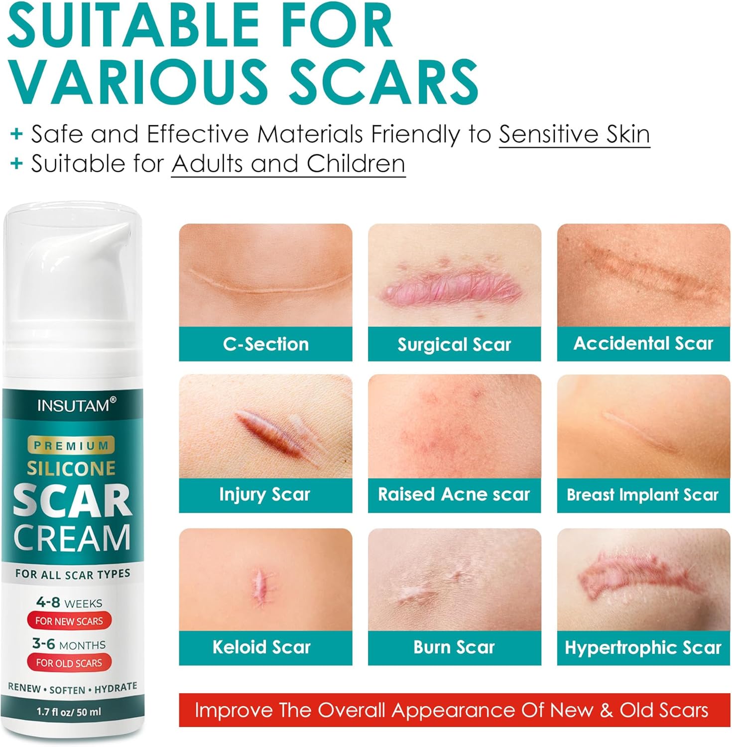 Silicone Scar Cream Gel for Scars: Medical Grade Silicone for Old and New Scars (White) - Image 3