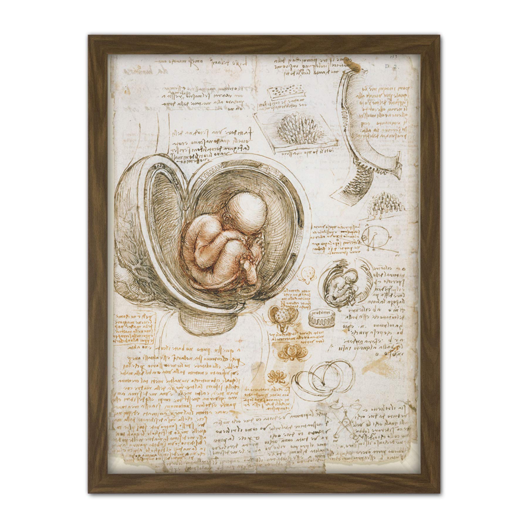 Artery8 Leonardo Da Vinci Studies Of The Foetus In Womb Artwork Framed Wall Art Print 18X24 Inch