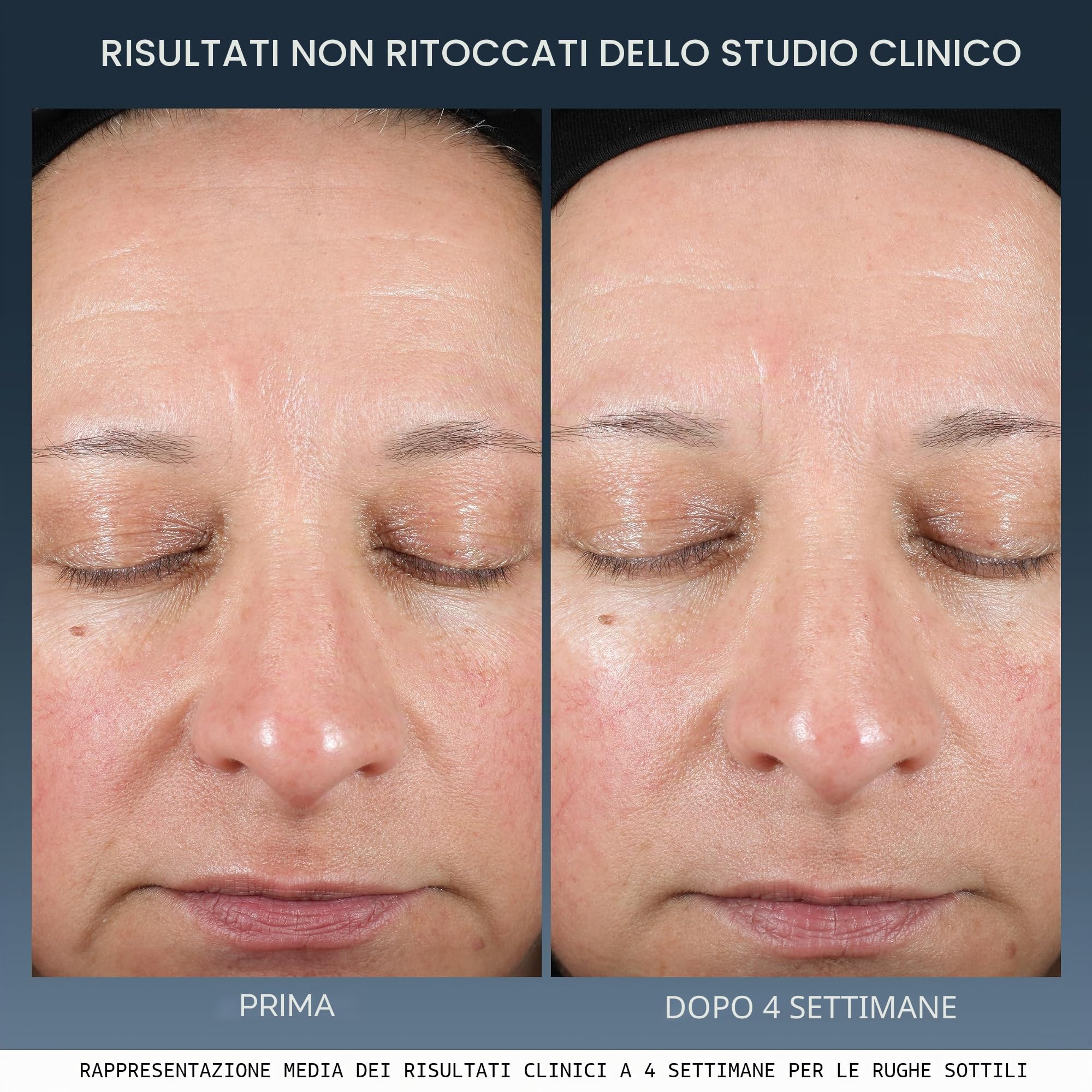 Lancôme - Crema Notte Riparatrice Advanced Génifique - Idratante, Levigante, Antietà - Crema Viso Antirughe - Pre e Probiotici, Tre Tipi di Ceramidi, Acido Ialuronico - 50ml