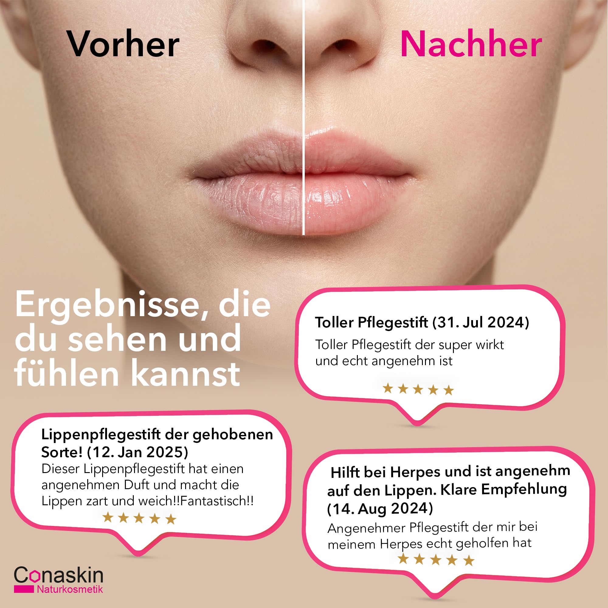 MANUKA Lippenpflege (MGO400) | Intensiv-Pflege bei Trockenheit & Infektionen (z. B. Herpes) | 4.6 g Naturkosmetik | Tägliche Anwendung & Repair | Bienenwachs & Propolis