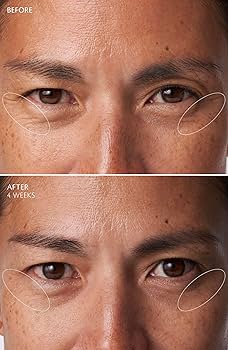 Amazon.com: Clé de Peau Beauté, Eye Contour Cream Supreme Refill