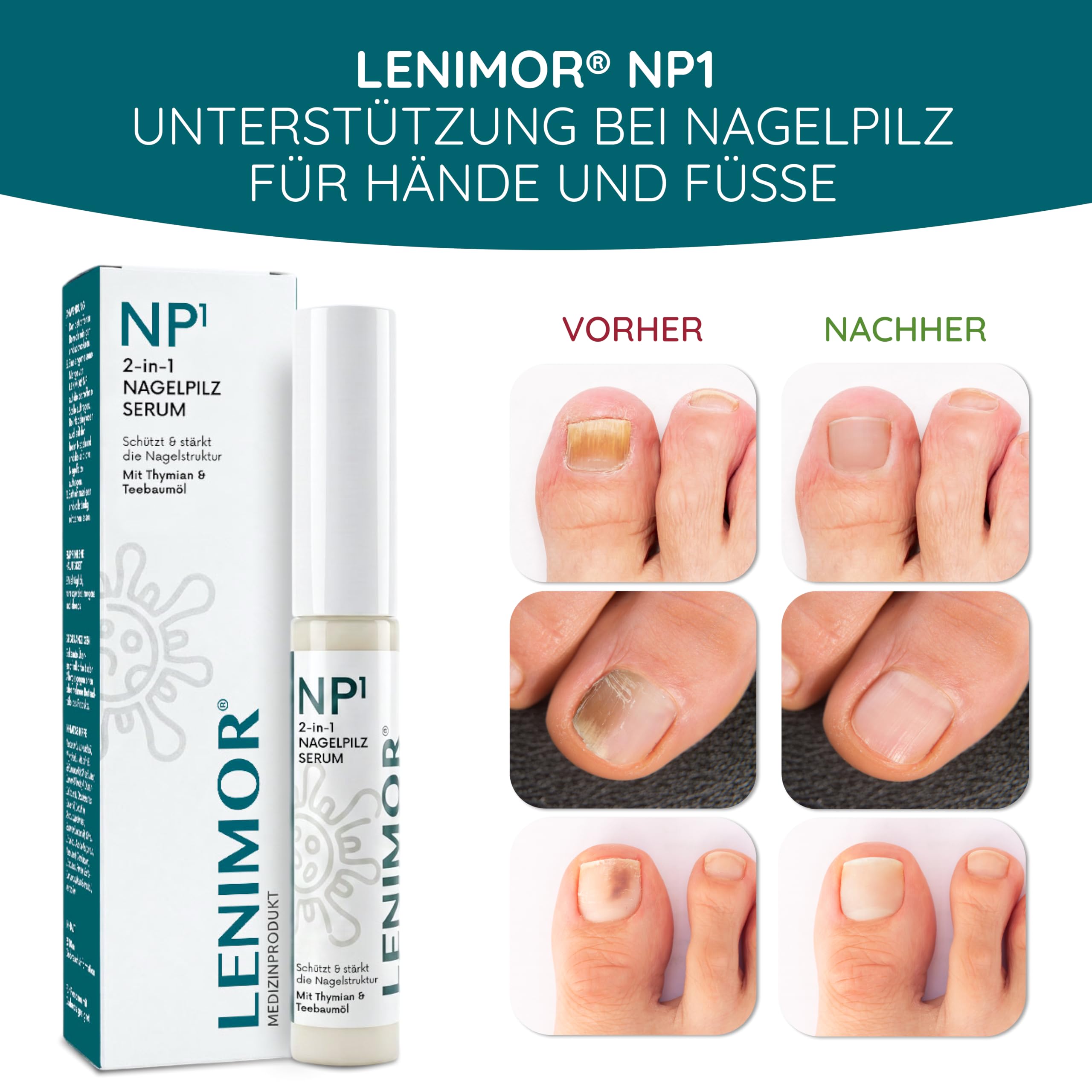 LENIMOR® NP1 | PREMIUM NAGELPILZ 2-in-1 für schöne & gesunde Nägel 10ml | CE-Medizinprodukt | Natürliche Formel mit Teebaumöl & Vitamin E | Nagelhärter | Made in Italy