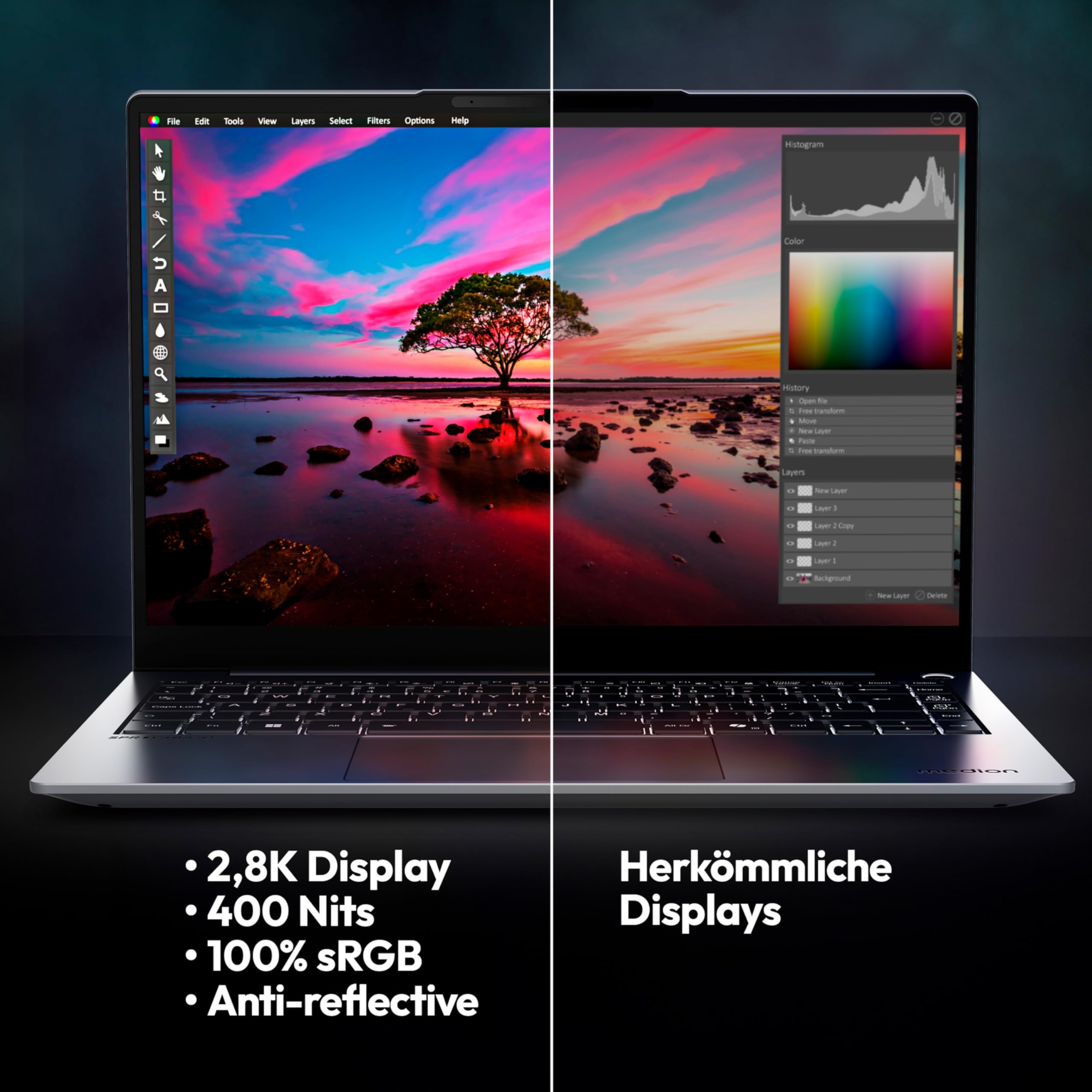 MEDION SPRCHRGD 14 S2 35,56 cm (14" Zoll 120Hz 2.8K WQXGA+) Laptop (Copilot+ PC, Core Ultra 5 228V, 32GB DDR5 RAM, 512GB SSD, Windows 11 Home)