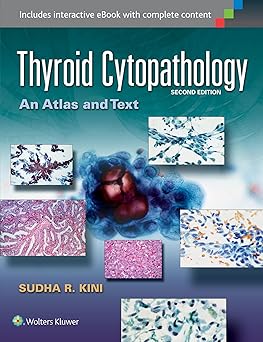 Thyroid Cytopathology An Atlas And Text 2Ed (Hb 2015)