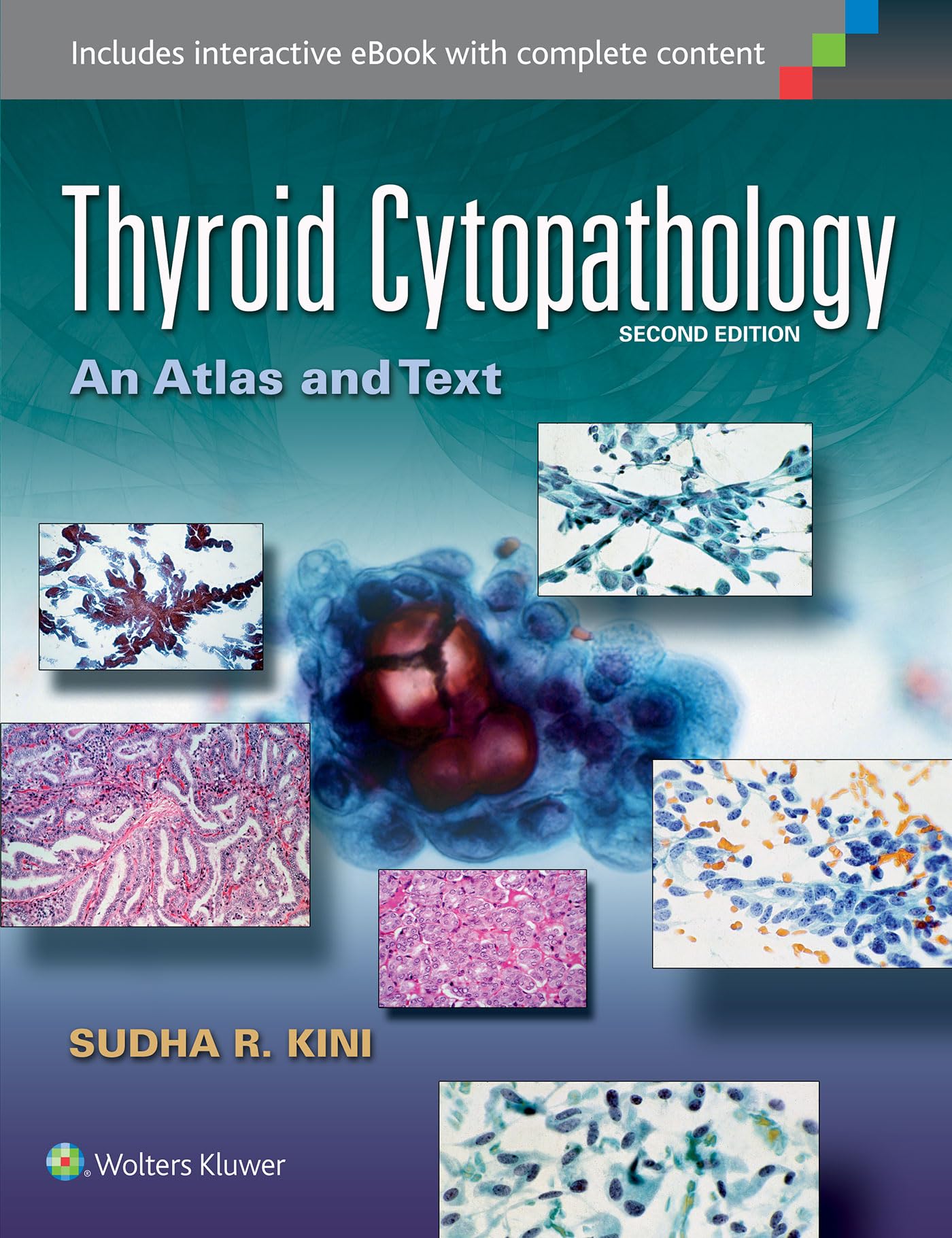 語学+参考書 Thyroid Cancer Explore Vol.3No 語学+参考書 Thyroid Cancer Explore Vol.3No 語学+参考書