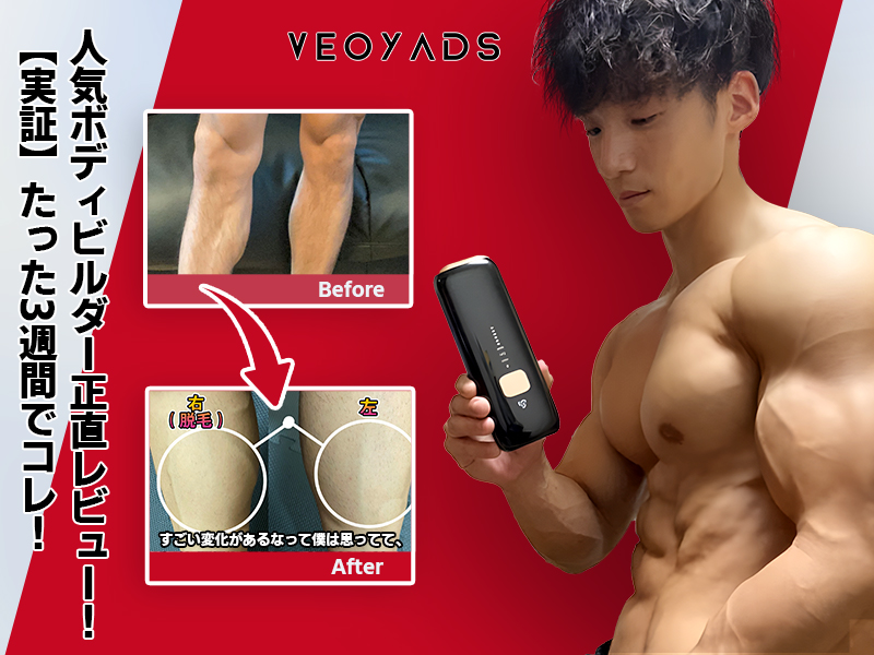 Amazon | VEOYADS HIPL 脱毛器【ドイツのiFデザイン賞受賞 サファイア