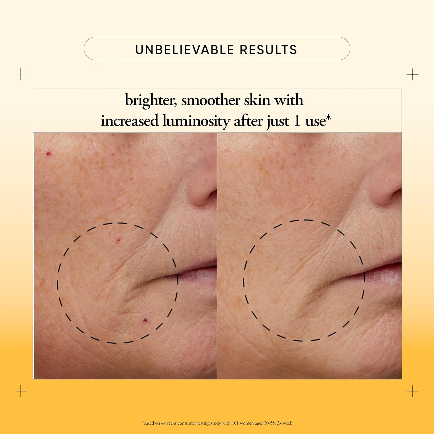 philosophy microdelivery vitamin c resurfacing peel kit - with lactic acid & sunflower seed oil - two-step treatment to smooth rough texture, even skin tone and minimize the appearance of fine lines - Image 4