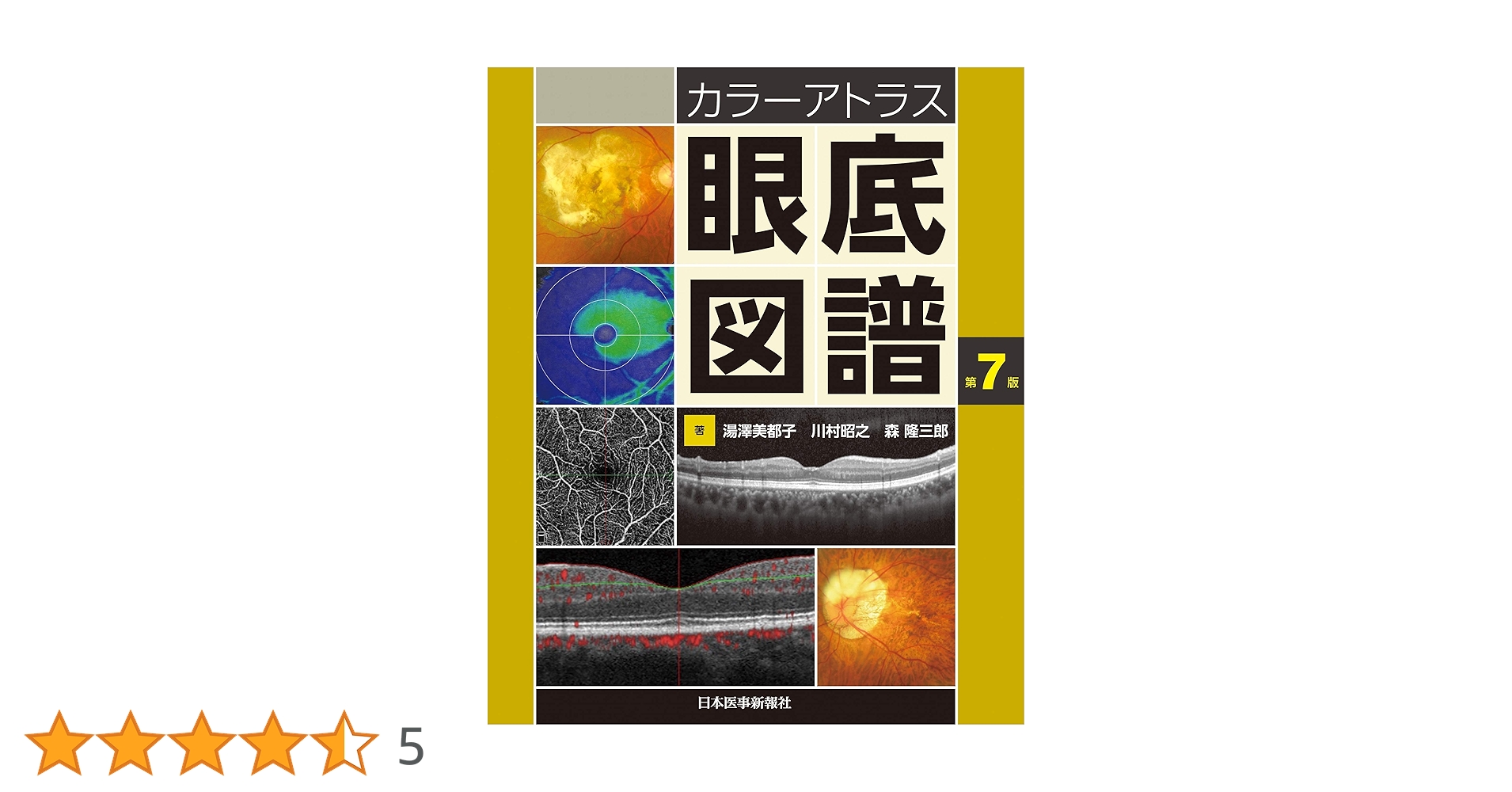 カラーアトラス　眼底図譜 カラーアトラス眼底図譜 | 湯澤美都子, 川村昭之, 森隆三郎 |本