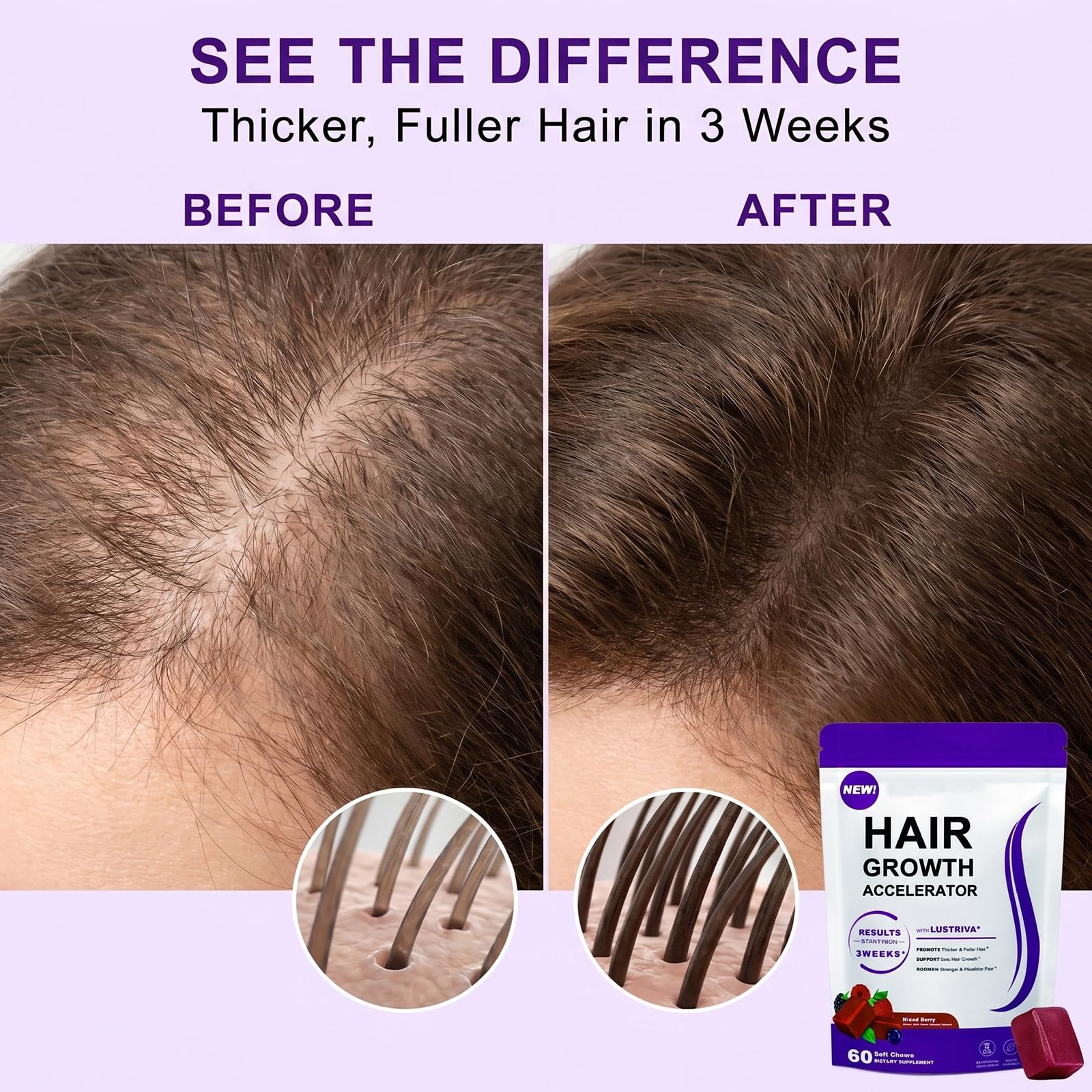 60 Integratori Gommosi For La Crescita Dei Capelli: Supportano Capelli Sani Con Biotina E Vitamine, Deliziosi Facili Da Assumere