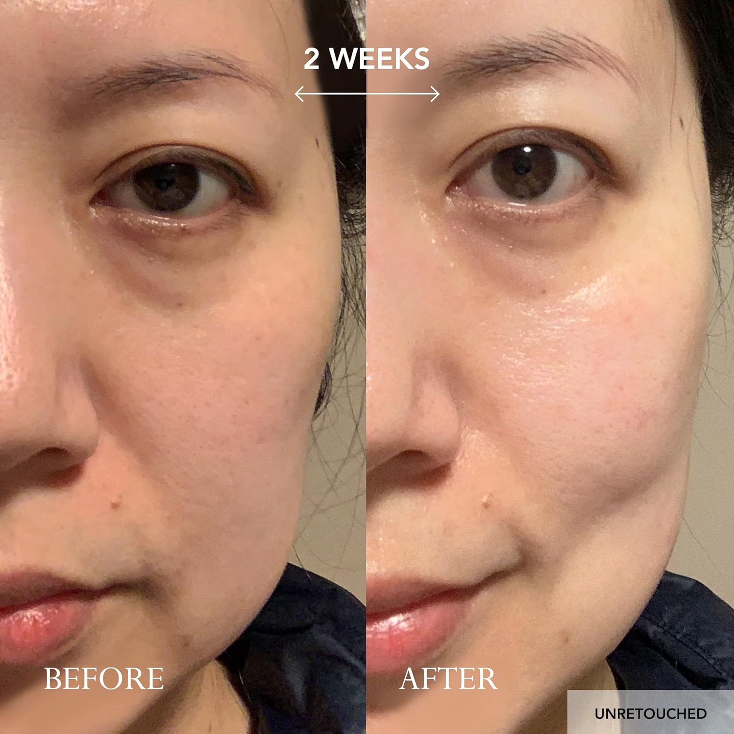 Kat Burki 8% Vitamin C Nourishing Cleansing Balm with KB5 Complex, Gentle Makeup Remover & Hydrating Facial Cleanser with Vitamin E, Rosehip & Avocado Oils 3.4 Fl Oz - Image 5