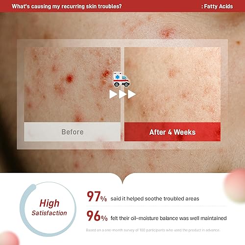 Miniatura 3 de Zeroca 81 Serum Suero coreano de rosa silvestre para piel sensible y propensa al acné Equilibra el aceite y el agua, alivia el enrojecimiento,