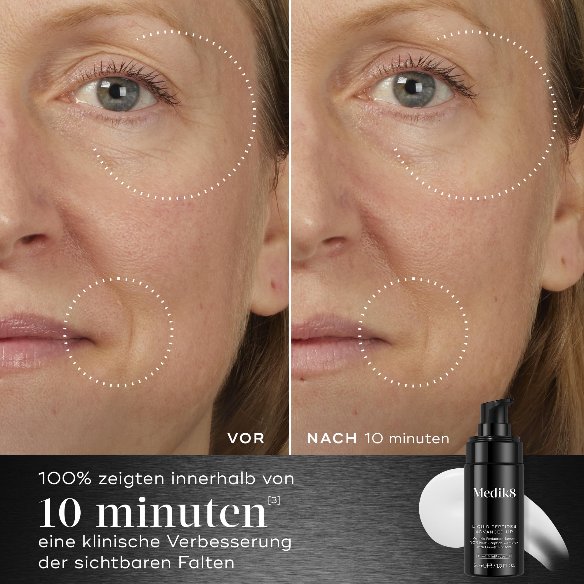 Medik8 Liquid Peptides Advanced MP, Bahnbrechende Bio-Technologie - 30 ml | Serum zur Faltenreduzierung mit 30 % Multi-Peptid-Komplex – nachweisliche Ergebnisse in nur 10 Minuten