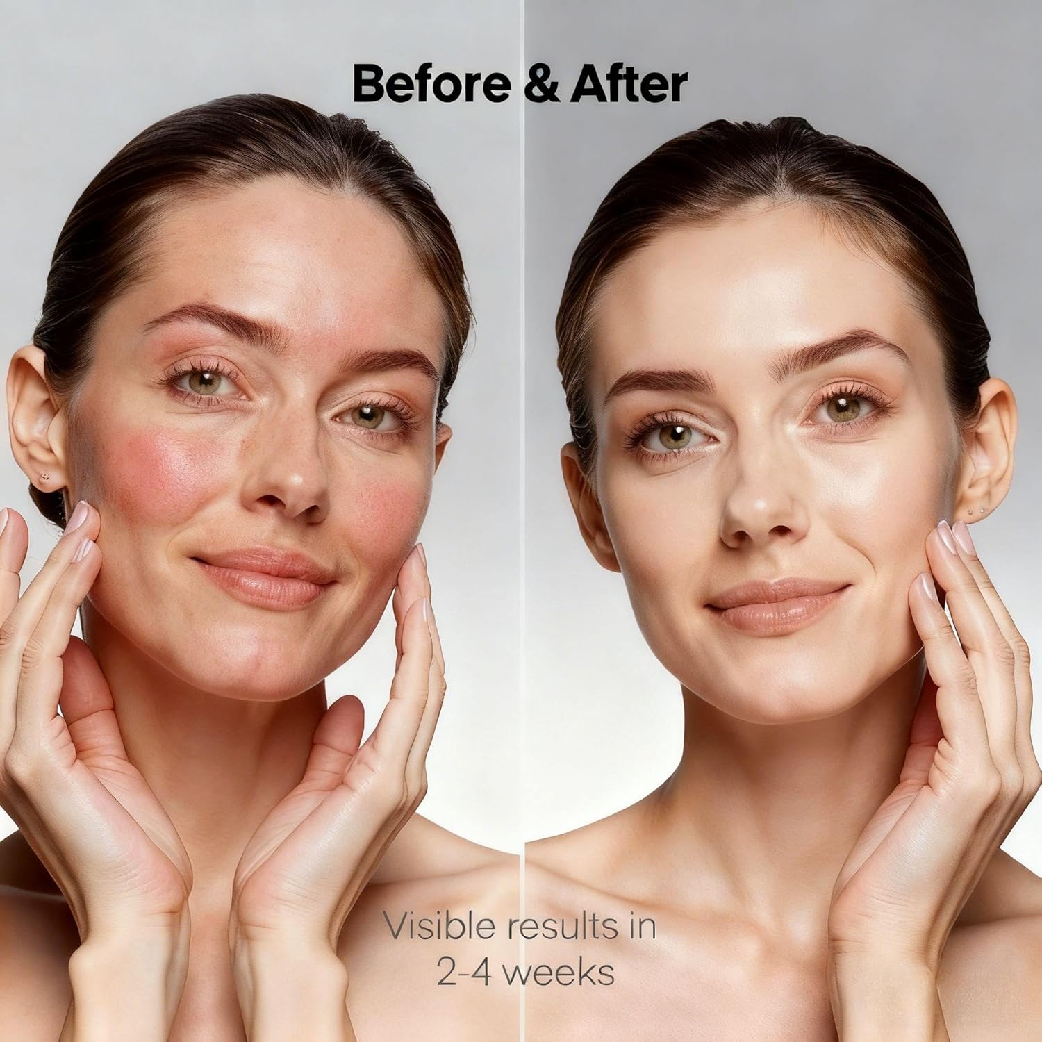 Diamond Micro-dermabrasion Machine, 2 in 1 Dermabrasion Facial Machine for Exfoliation & Blackhead Removal, Home Use Facial Skin Care Device - Image 3