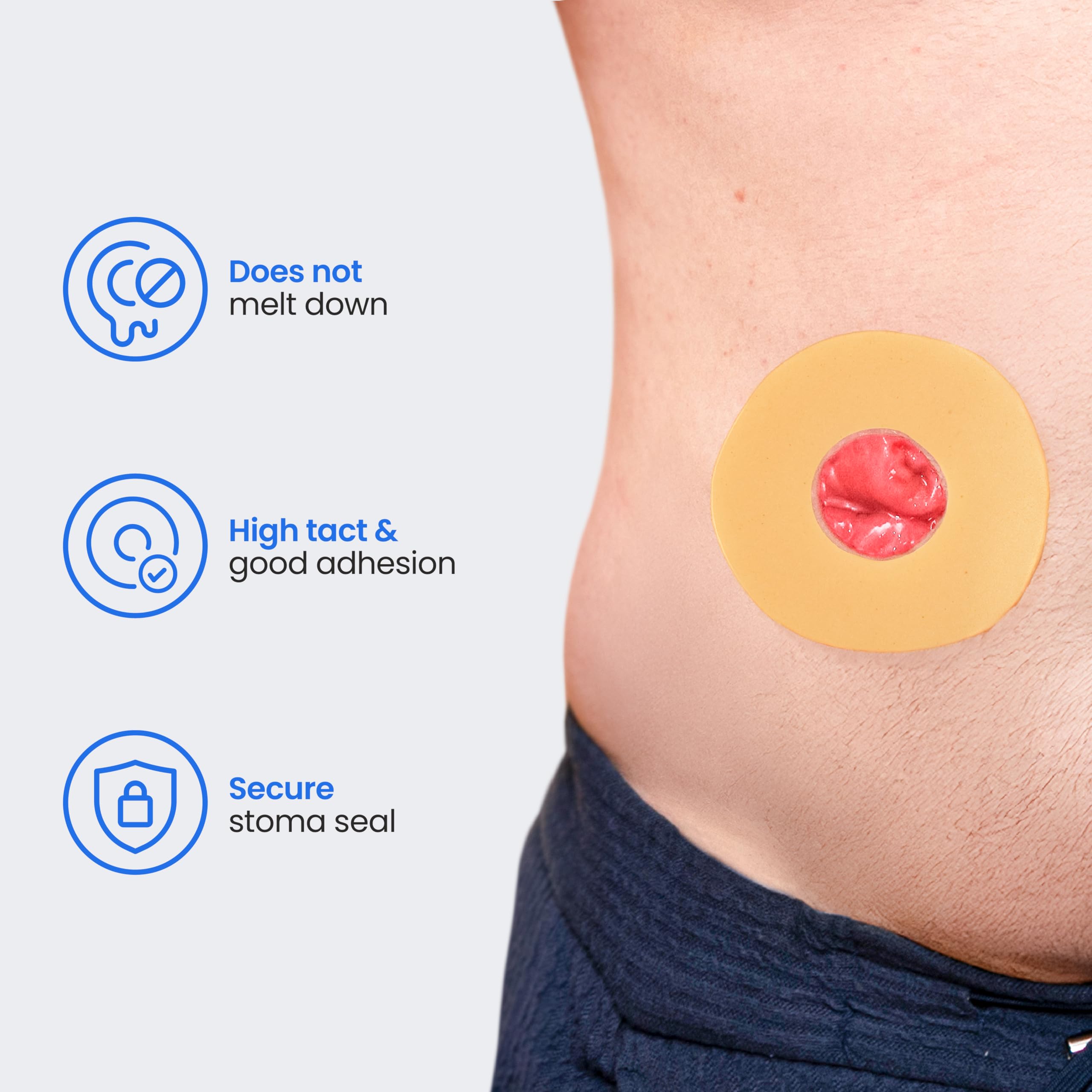 Safe n' Simple Conforming Adhesive Seals -2 Inch - Pack of 10 - Stoma Barrier Rings Barrier - Cohesive Skin Barrier - Accessories for Ostomy-Colostomy-Ileostomy- Supplies