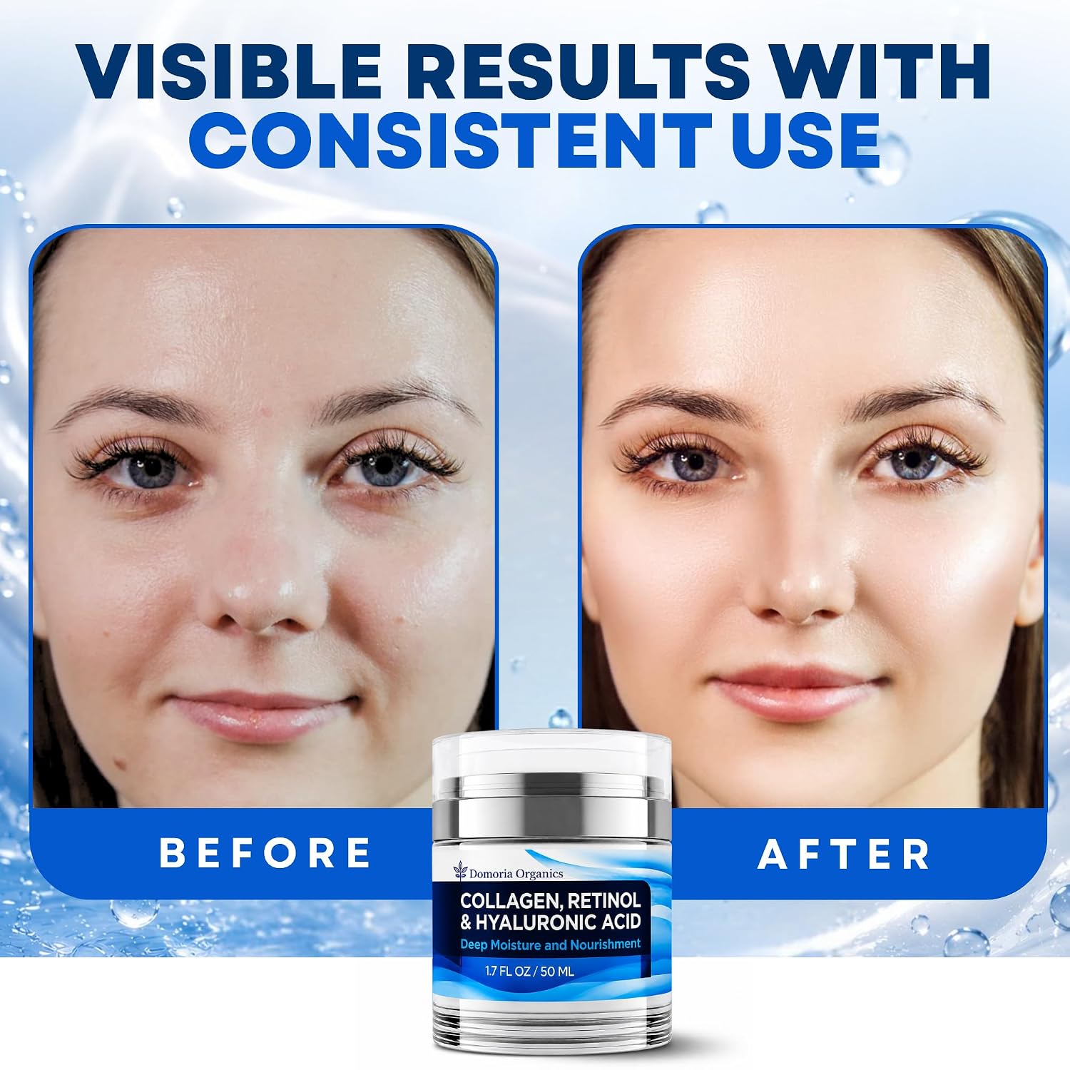 Retinol Collagen & Hyaluronic Acid Moisturizer for Face & Neck, Anti Aging Cream, Hydrating Cream for Women & Men, 1.7 Fl Oz